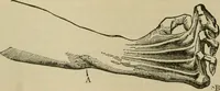 An illustration from Modern surgery, general and operative / by John Chalmers DaCosta. (1914)