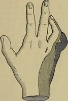 An illustration from Modern surgery, general and operative / by John Chalmers DaCosta. (1914)