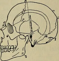 An illustration from Modern surgery, general and operative / by John Chalmers DaCosta. (1914)