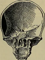 An illustration from Modern surgery, general and operative / by John Chalmers DaCosta. (1914)