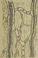 An illustration from Modern surgery, general and operative / by John Chalmers DaCosta. (1914)