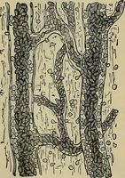 An illustration from Modern surgery, general and operative / by John Chalmers DaCosta. (1914)