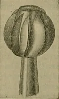 An illustration from Modern surgery, general and operative / by John Chalmers DaCosta. (1914)