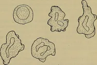 An illustration from Modern surgery, general and operative / by John Chalmers DaCosta. (1914)