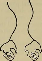 An illustration from Modern surgery, general and operative / by John Chalmers DaCosta. (1914)
