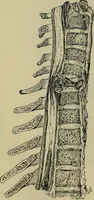 An illustration from Modern surgery, general and operative / by John Chalmers DaCosta. (1914)