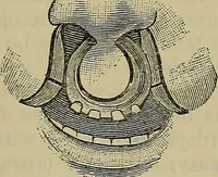 An illustration from Modern surgery, general and operative / by John Chalmers DaCosta. (1914)