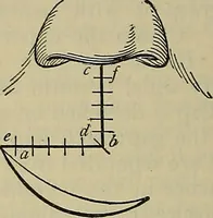 An illustration from Modern surgery, general and operative / by John Chalmers DaCosta. (1914)