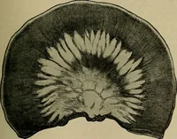 An illustration from Modern surgery, general and operative / by John Chalmers DaCosta. (1914)