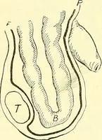 Picture 368 of 481 from Modern surgery, general and operative / by John Chalmers Da Costa. (1907), leaf 1026