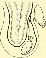Picture 369 of 481 from Modern surgery, general and operative / by John Chalmers Da Costa. (1907), leaf 1026