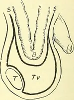 Picture 370 of 481 from Modern surgery, general and operative / by John Chalmers Da Costa. (1907), leaf 1026