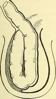 An illustration from Modern surgery, general and operative / by John Chalmers Da Costa. (1907)