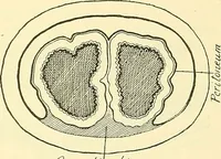 Picture 371 of 481 from Modern surgery, general and operative / by John Chalmers Da Costa. (1907), leaf 1027