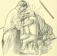 Picture 374 of 481 from Modern surgery, general and operative / by John Chalmers Da Costa. (1907), leaf 1032