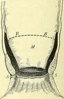 Picture 377 of 481 from Modern surgery, general and operative / by John Chalmers Da Costa. (1907), leaf 1042