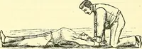 An illustration from Modern surgery, general and operative / by John Chalmers Da Costa. (1907)