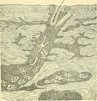 Picture 391 of 481 from Modern surgery, general and operative / by John Chalmers Da Costa. (1907), leaf 1085