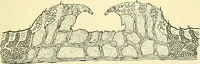 Picture 392 of 481 from Modern surgery, general and operative / by John Chalmers Da Costa. (1907), leaf 1085