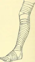 Picture 399 of 481 from Modern surgery, general and operative / by John Chalmers Da Costa. (1907), leaf 1108