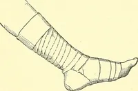 Picture 400 of 481 from Modern surgery, general and operative / by John Chalmers Da Costa. (1907), leaf 1108