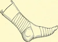Picture 401 of 481 from Modern surgery, general and operative / by John Chalmers Da Costa. (1907), leaf 1108