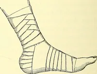 Picture 402 of 481 from Modern surgery, general and operative / by John Chalmers Da Costa. (1907), leaf 1108