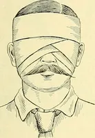 Picture 403 of 481 from Modern surgery, general and operative / by John Chalmers Da Costa. (1907), leaf 1109