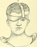 Picture 406 of 481 from Modern surgery, general and operative / by John Chalmers Da Costa. (1907), leaf 1110