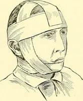 Picture 407 of 481 from Modern surgery, general and operative / by John Chalmers Da Costa. (1907), leaf 1110
