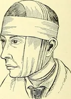Picture 408 of 481 from Modern surgery, general and operative / by John Chalmers Da Costa. (1907), leaf 1110