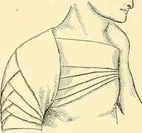 Picture 410 of 481 from Modern surgery, general and operative / by John Chalmers Da Costa. (1907), leaf 1111