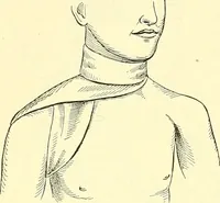 An illustration from Modern surgery, general and operative / by John Chalmers Da Costa. (1907)