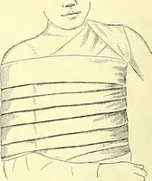 An illustration from Modern surgery, general and operative / by John Chalmers Da Costa. (1907)
