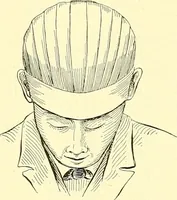 Picture 414 of 481 from Modern surgery, general and operative / by John Chalmers Da Costa. (1907), leaf 1114