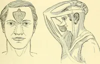 An illustration from Modern surgery, general and operative / by John Chalmers Da Costa. (1907)