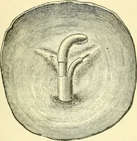 Picture 418 of 481 from Modern surgery, general and operative / by John Chalmers Da Costa. (1907), leaf 1121