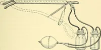 Picture 419 of 481 from Modern surgery, general and operative / by John Chalmers Da Costa. (1907), leaf 1123