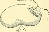 An illustration from Modern surgery, general and operative / by John Chalmers Da Costa. (1907)