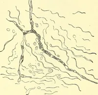 Picture 46 of 481 from Modern surgery, general and operative / by John Chalmers Da Costa. (1907), leaf 120