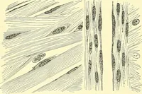Picture 47 of 481 from Modern surgery, general and operative / by John Chalmers Da Costa. (1907), leaf 120