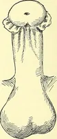 An illustration from Modern surgery, general and operative / by John Chalmers Da Costa. (1907)