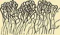 Picture 48 of 481 from Modern surgery, general and operative / by John Chalmers Da Costa. (1907), leaf 121