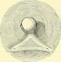 Picture 449 of 481 from Modern surgery, general and operative / by John Chalmers Da Costa. (1907), leaf 1220