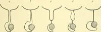 Picture 450 of 481 from Modern surgery, general and operative / by John Chalmers Da Costa. (1907), leaf 1227
