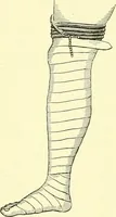 An illustration from Modern surgery, general and operative / by John Chalmers Da Costa. (1907)