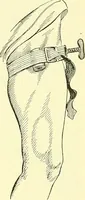 An illustration from Modern surgery, general and operative / by John Chalmers Da Costa. (1907)