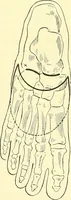An illustration from Modern surgery, general and operative / by John Chalmers Da Costa. (1907)