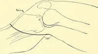 An illustration from Modern surgery, general and operative / by John Chalmers Da Costa. (1907)