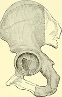 An illustration from Modern surgery, general and operative / by John Chalmers Da Costa. (1907)